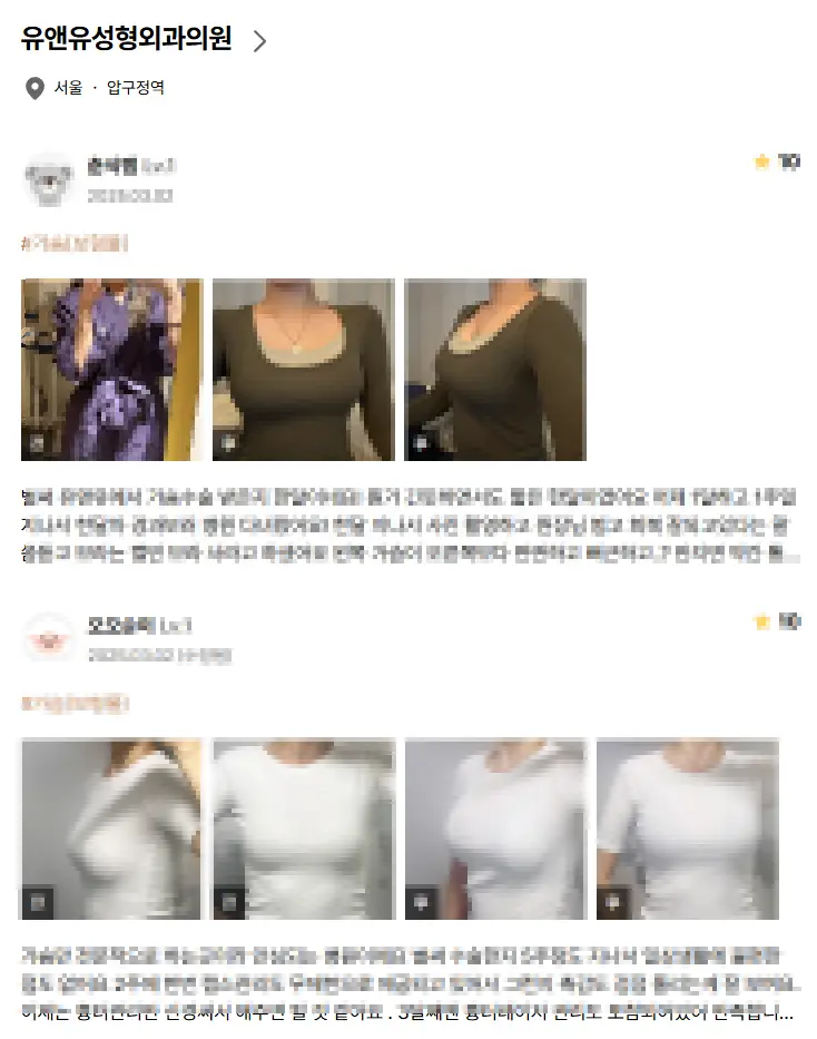 Стоимость подтяжки груди? Почему узнавать цену первым делом бессмысленно. — иллюстрация статьи 7
