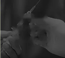 Сертификация запрета повторного использования одноразовых изделий