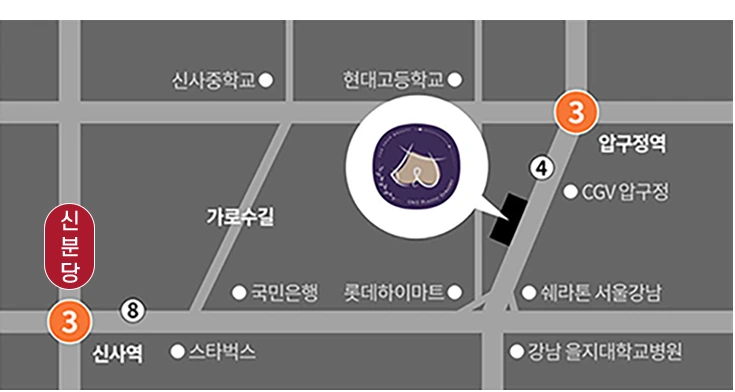 Схема проезда в клинику U&U: рядом с выходом 4 станции Апкучжон (линия 3), станцией Синса и улицей Каросу-гиль