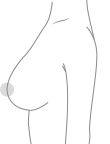 k1
