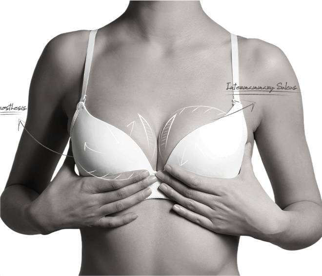 Happy Breast Обучение подбору бюстгальтера img1 m