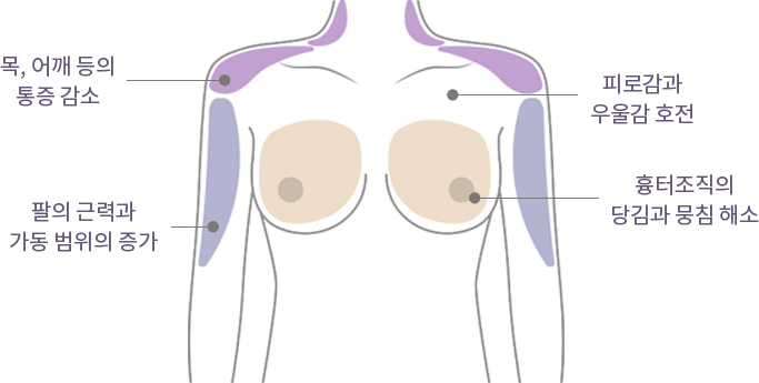 Happy Breast Пилатес img3 m