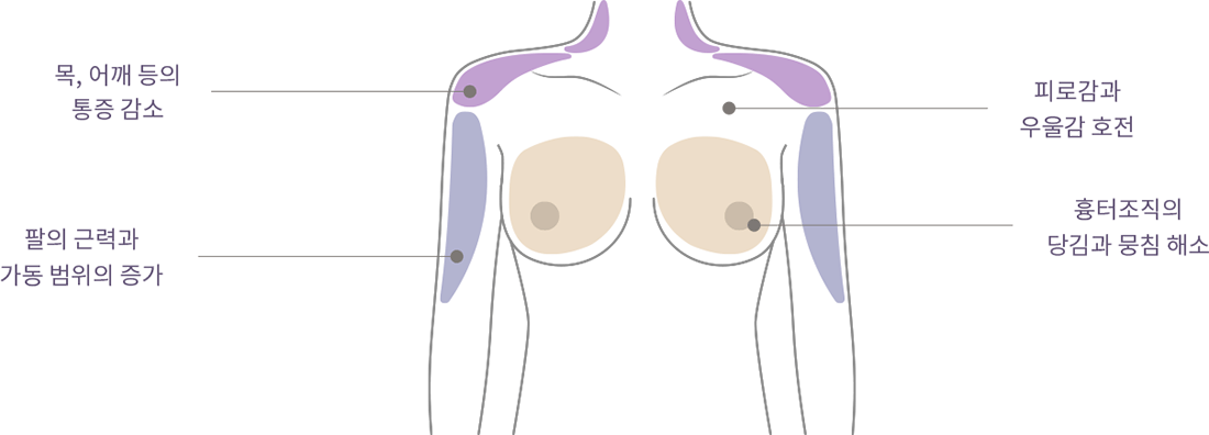 happy breast Пилатес img3